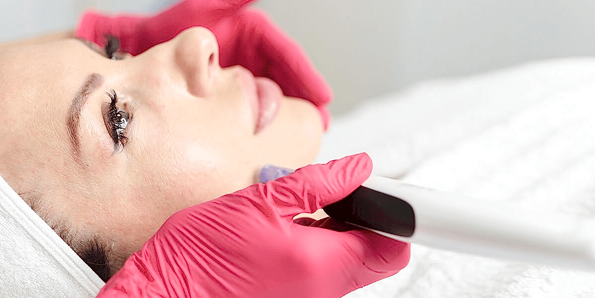 Микроигольчатый RF-лифтинг VIVACE