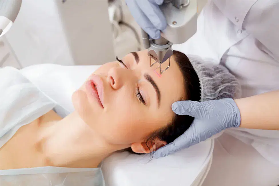 Лазерная шлифовка лица